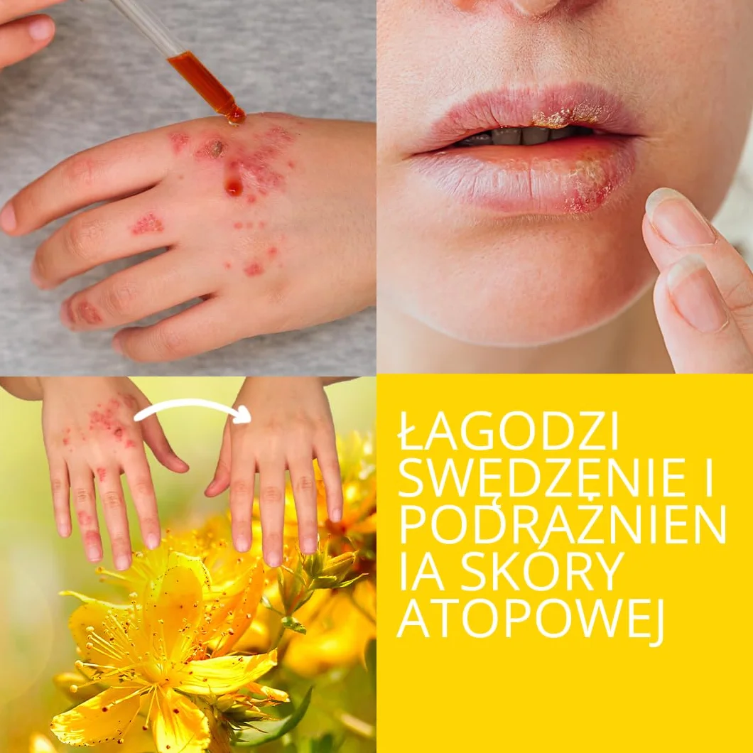 Olej z Dziurawca - Nawilżający i Naprawczy dla Skóry i Włosów. Przeciwdziałający Rozstępom w Ciąży, Olejek do Masażu Ciała, Ujędrniający Przeciw Cellulitowi i Przeciwstarzeniowy na Twarz 100 ml